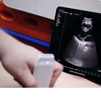 Drahtlose Ultraschall-Sonde in der Kardiologie verwendet