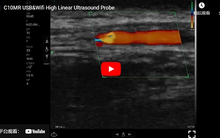 C10MR USB & Wifi Hochlineare Ultraschall-Sonde Demo