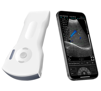 C10XS 2 in 1 Dual-Sonden Mehrzweck-Ultraschall konvexe lineare Sonde