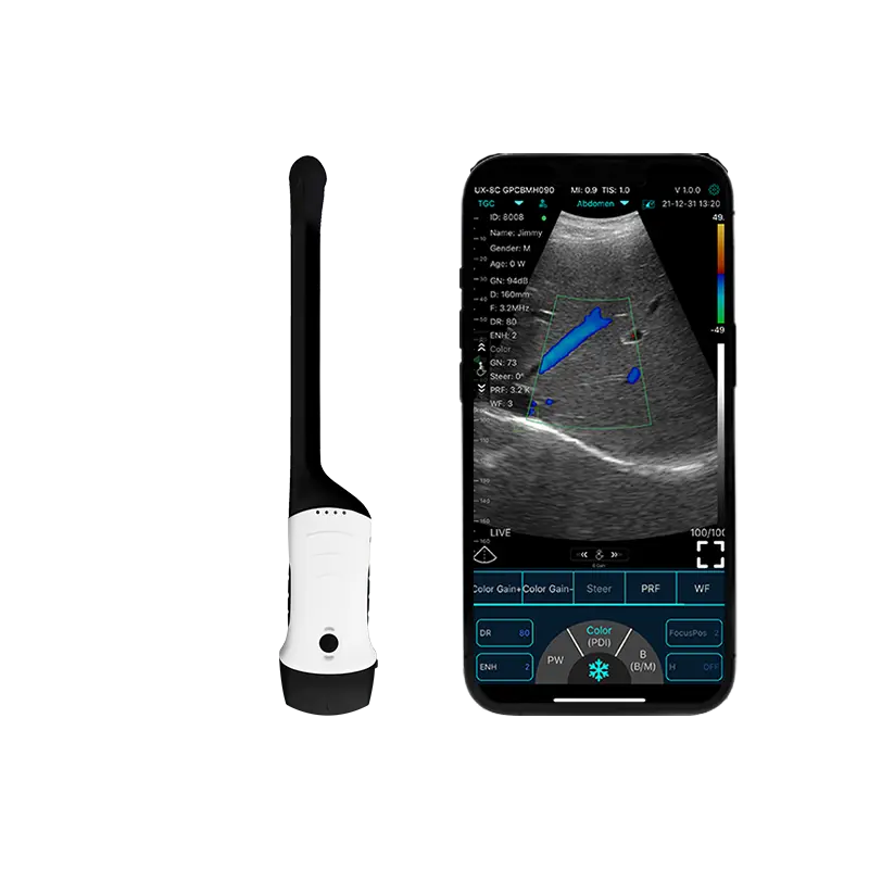 Der tragbare Ultraschall-Hands canner eröffnet eine neue Ära in der medizinischen Untersuchung